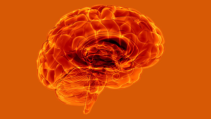 Datos, causas, riesgos y prevención de derrames cerebrales