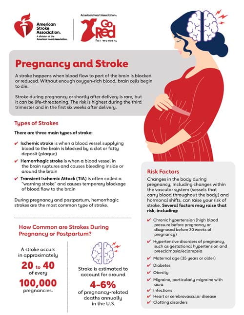 Pregnancy and Stroke PDF thumbnail