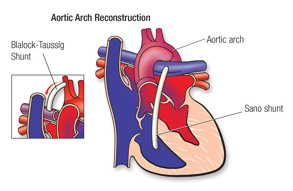 Aortic arch diagram