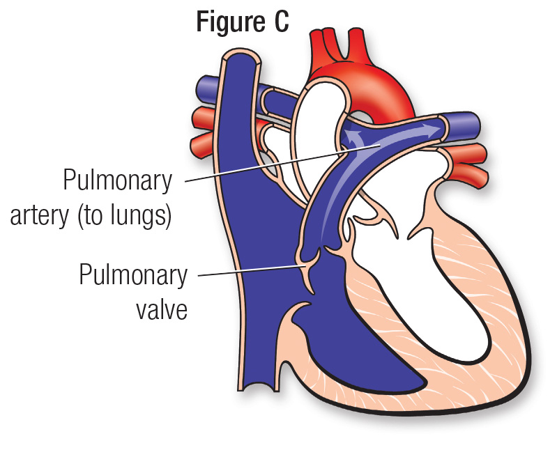 Figura C de un corazón normal