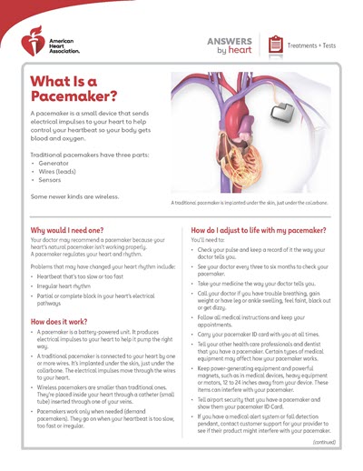 What is a pacemaker Answers by Heart sheet