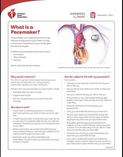 What is a pacemaker Answers by Heart sheet