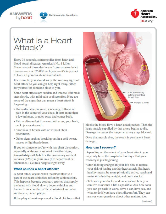 Hoja informativa sobre el ataque al corazón