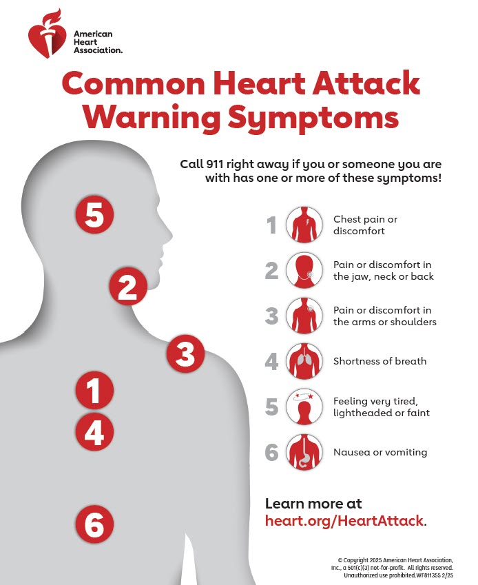 Signos de alarma comunes del ataque al corazón (infografía)