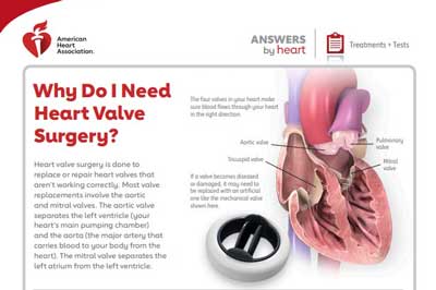 Hoja de respuestas del corazón para la cirugía de válvulas cardíacas