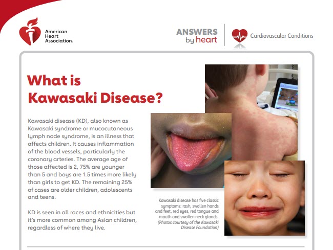At vise underviser bue Kawasaki Disease: Complications and Treatment | Go Red for Women