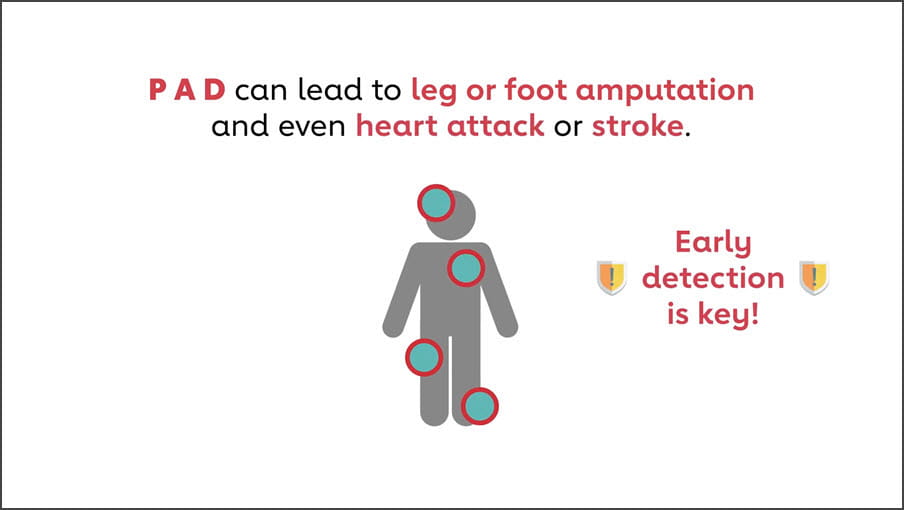 PAD Questions to Ask Your Doctor | Go Red for Women