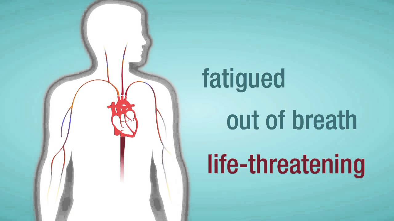 Captura de pantalla del video de insuficiencia de la válvula cardíaca