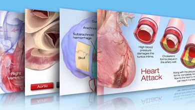 Imagen en miniatura de la biblioteca cardiovascular interactiva