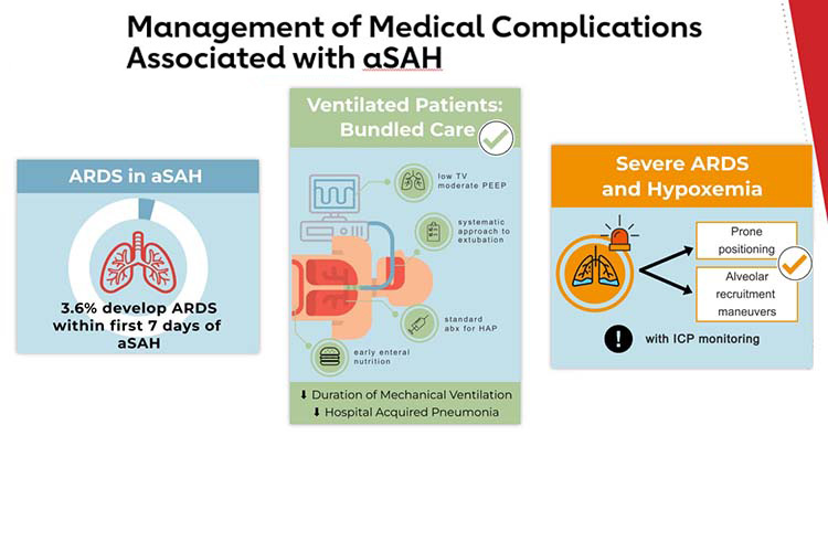 2023 Guideline for the Management of Patients With Aneurysmal