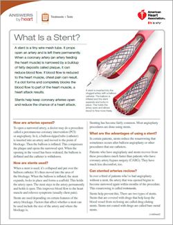 Stent sheet