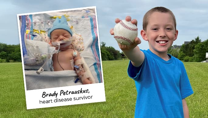 Image of Brady, Heart Disease survivor