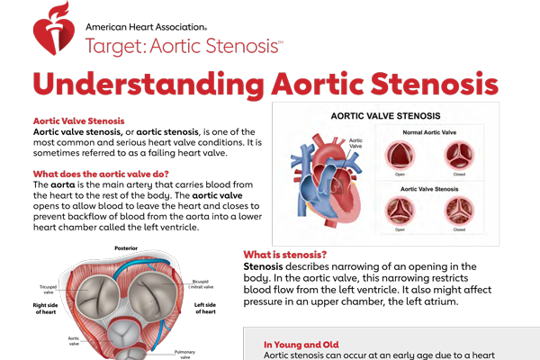 Understanding aortic stenosis overview