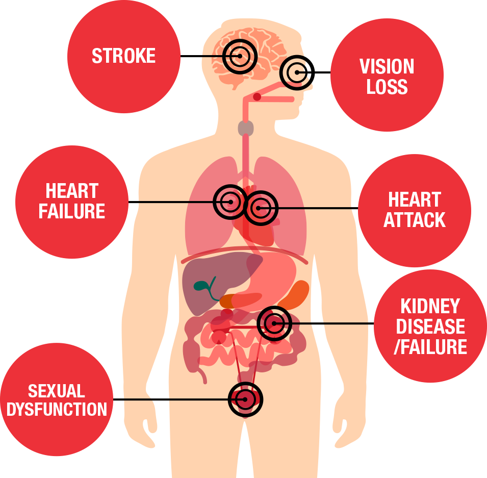 diagrama de amenazas para la salud
